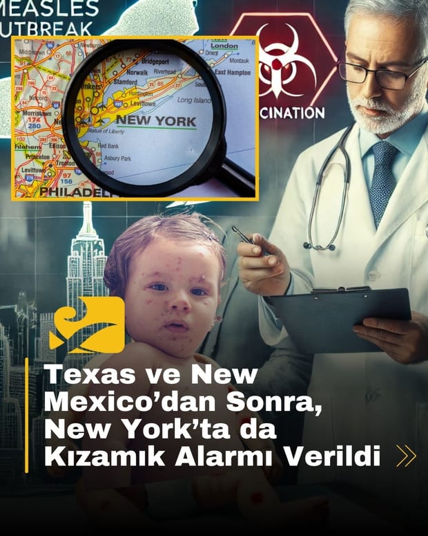 New York’ta aşısız bebeklerde iki kızamık vakası tespit edildi, yetkililer aşılama çağrısı yaptı