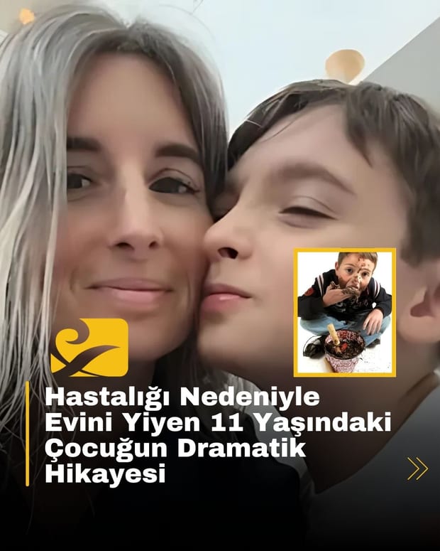 Teksas’ta yaşayan Charlie, Pika sendromu nedeniyle tehlikeli nesneler yemeye devam ediyor